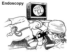 Endoscopy picture