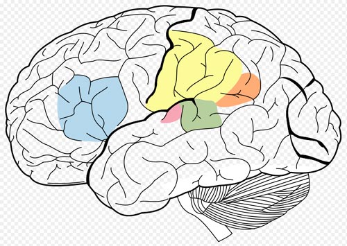 Some of the areas of the brain involved in language processing: Broca's area(Blue), Wernicke's area(Green), Supramarginal gyrus(Yellow), Angular gyrus(Orange) ,Primary Auditory Cortex(Pink)
