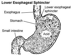 Lower Esophageal Sphincter picture
